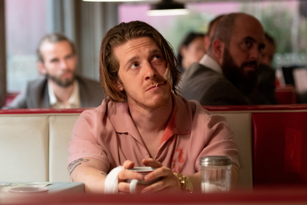 Photo of Adam Nagaitis as Virgil sitting at the Diner with his hand and cheek bandaged holding a coffee cup